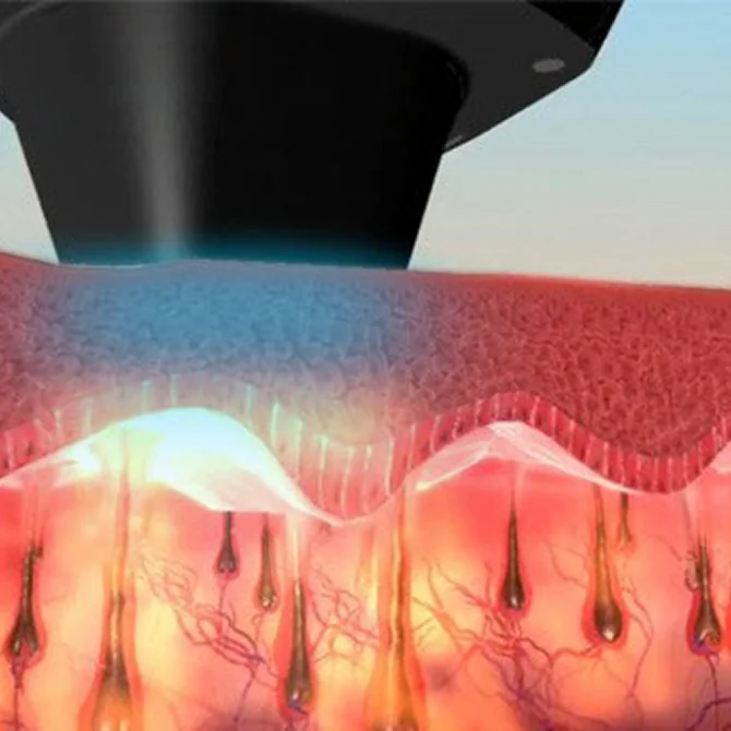 Advanced cooling system technology