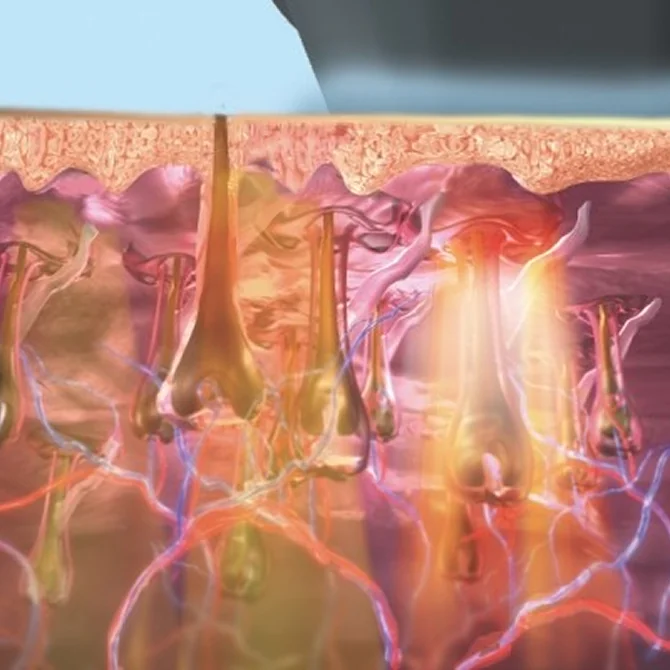 Specialized energy control systems