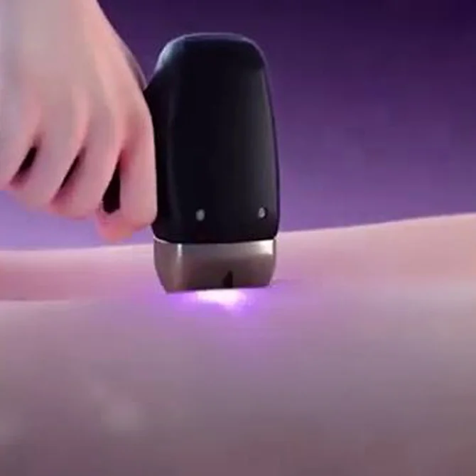 Minimal pain control system