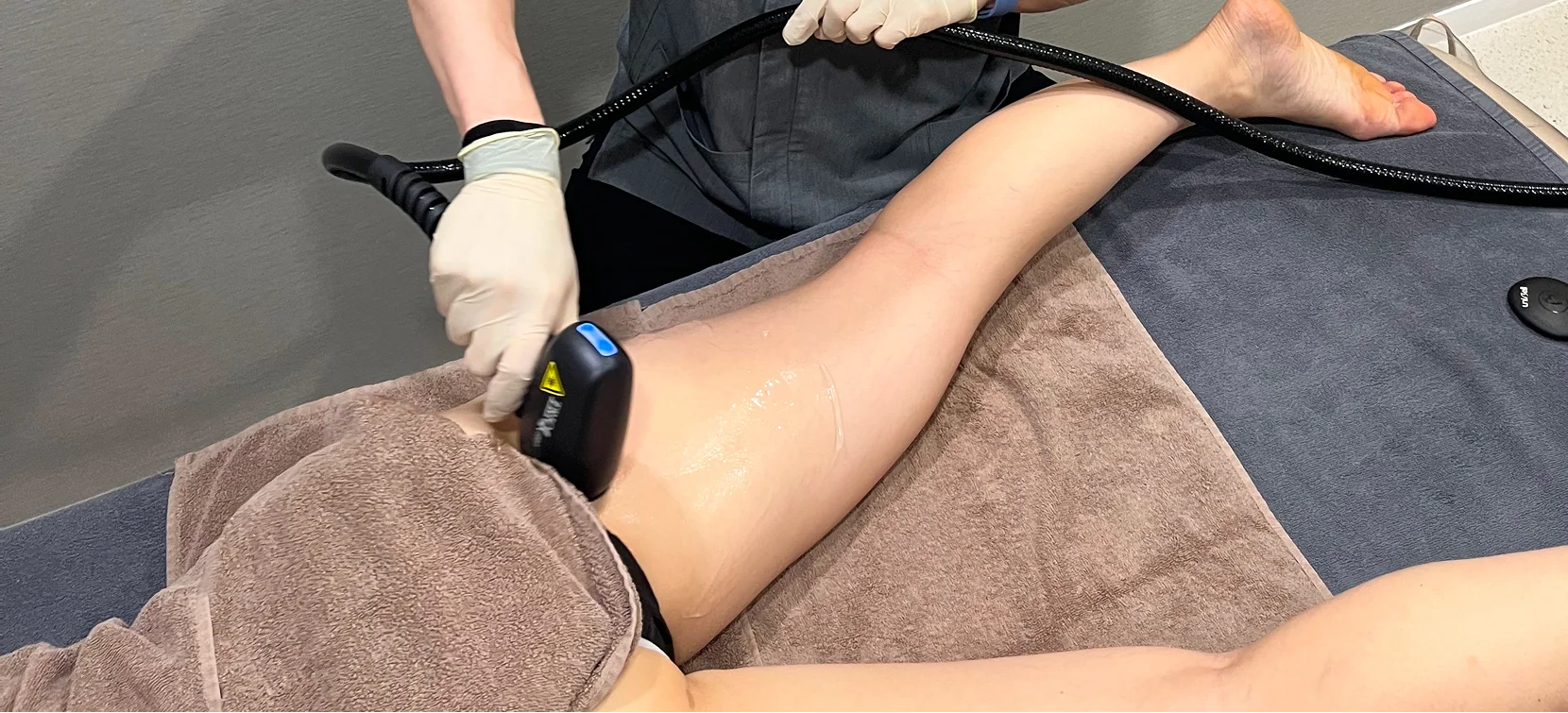 Body Only Tip Procedure