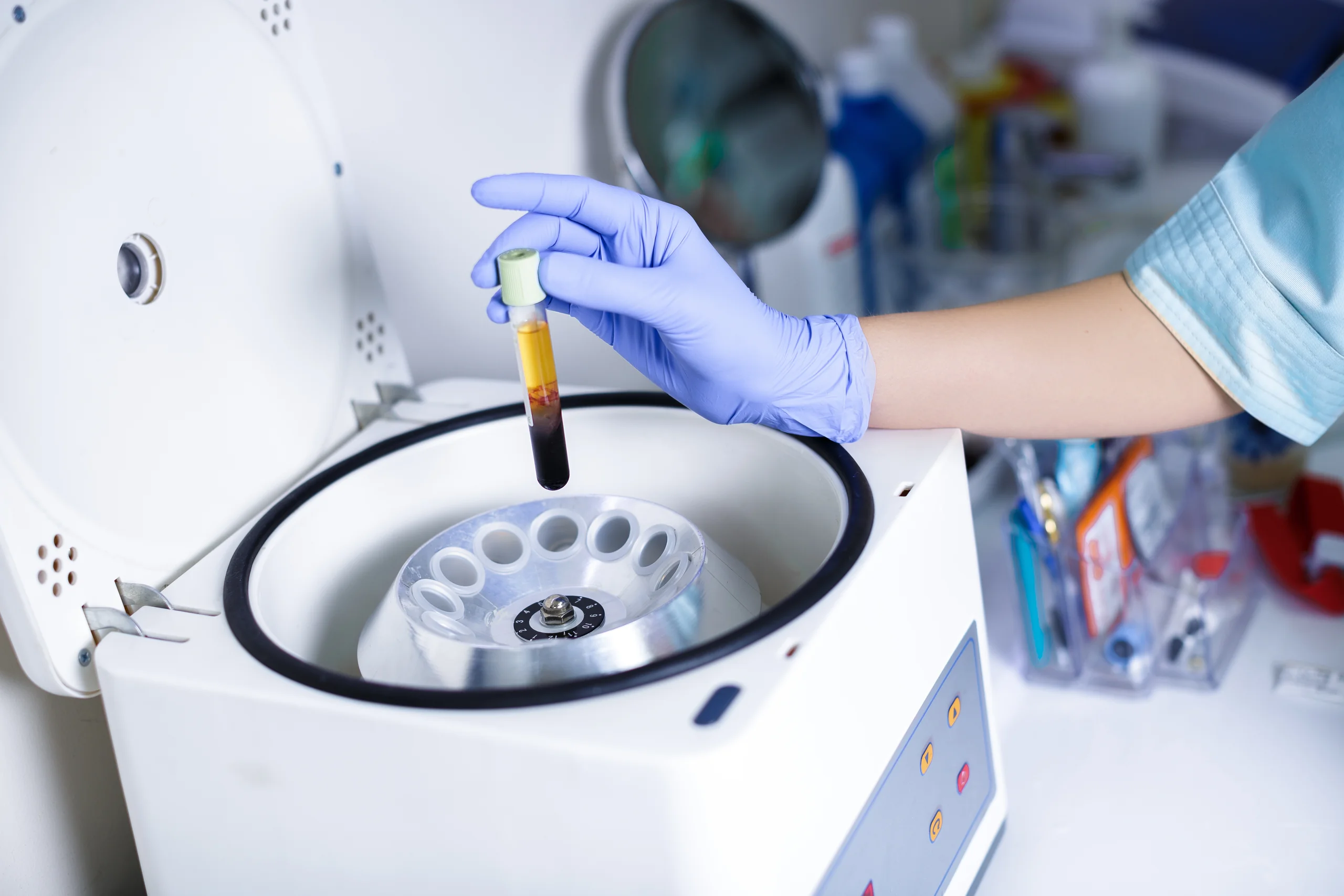 Centrifugation comparison visual image