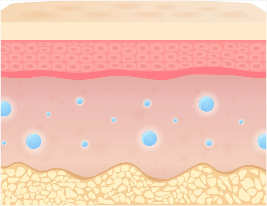 JUVÉROUGE Treatment Step 3 Skin Restoration