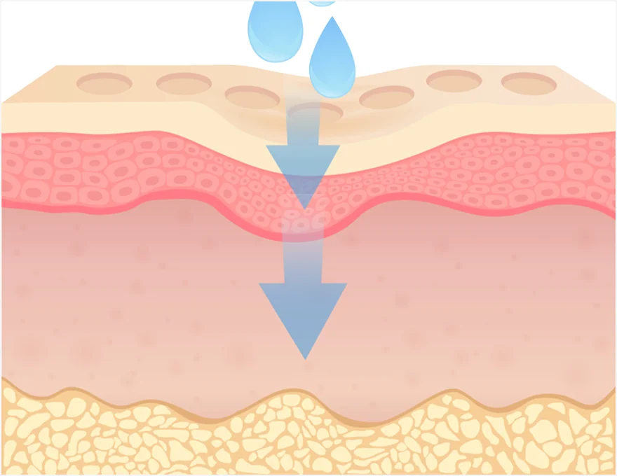Direct Retigen Collagen Filling