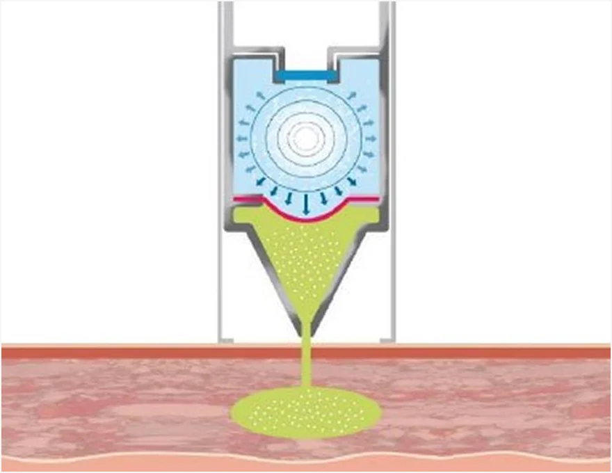 How Mirage Jet works in 3 steps