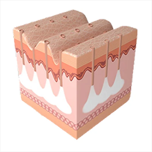 Mirage Jet Procedure 3