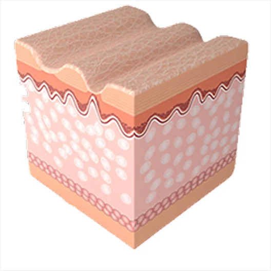 Mirage Jet Procedure 4