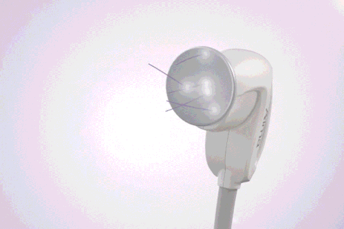 3D Stereoscopic Ultrasound System