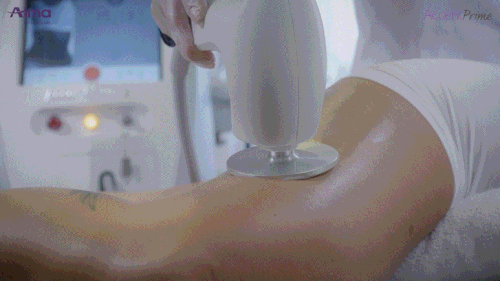 Simple anesthesia-free procedure system