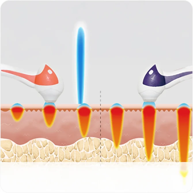 TuneFace 6-step depth adjustment customization procedure