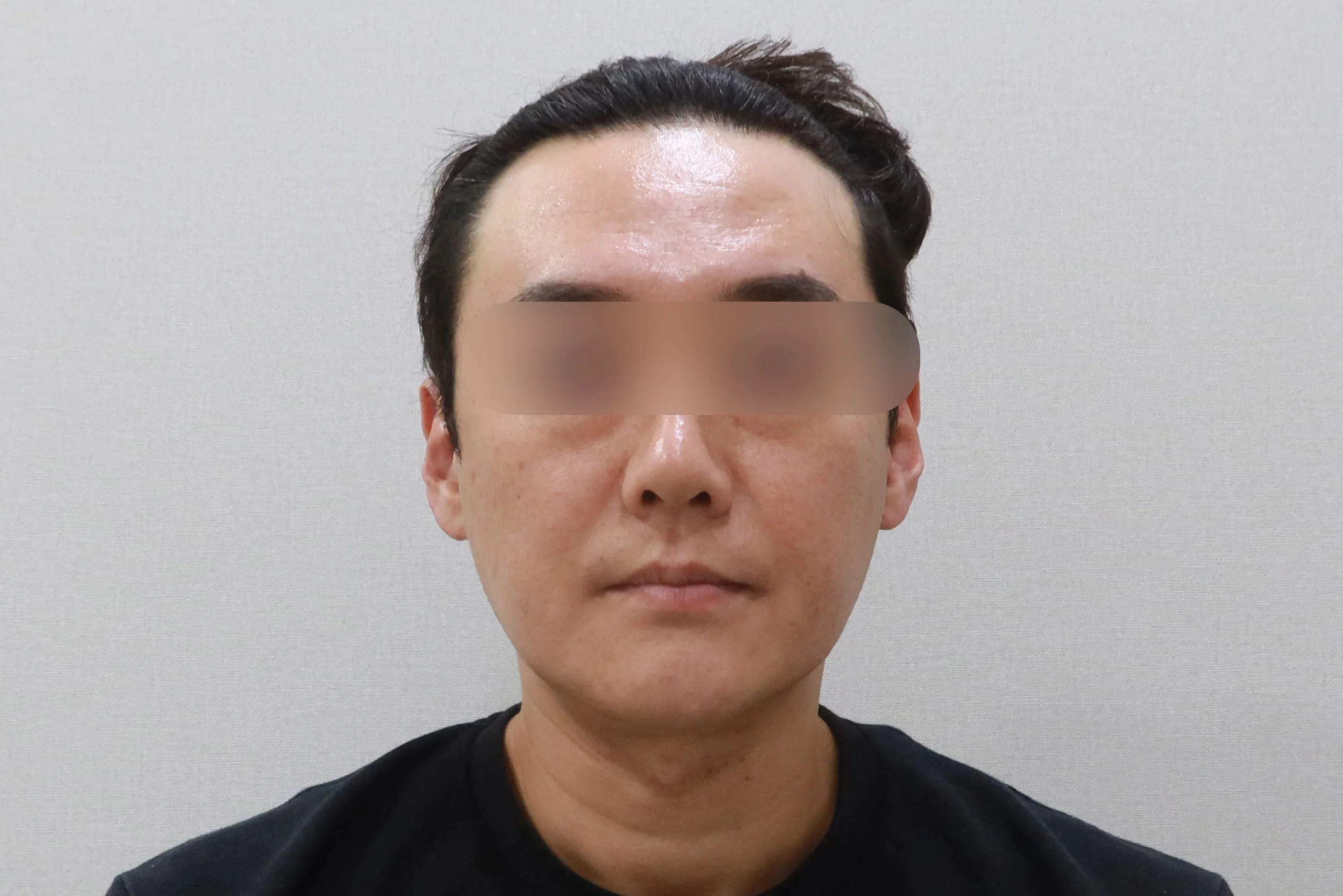 Face Eraser Full Frontal